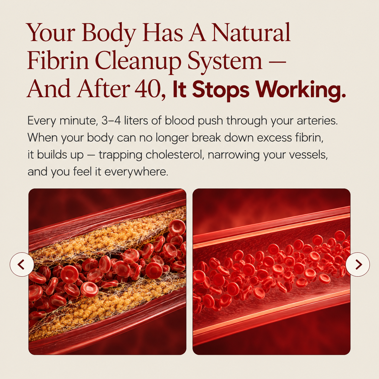 Nattokinase Softgels - 10,000 FU of Pure Circulation Support in Every Serving